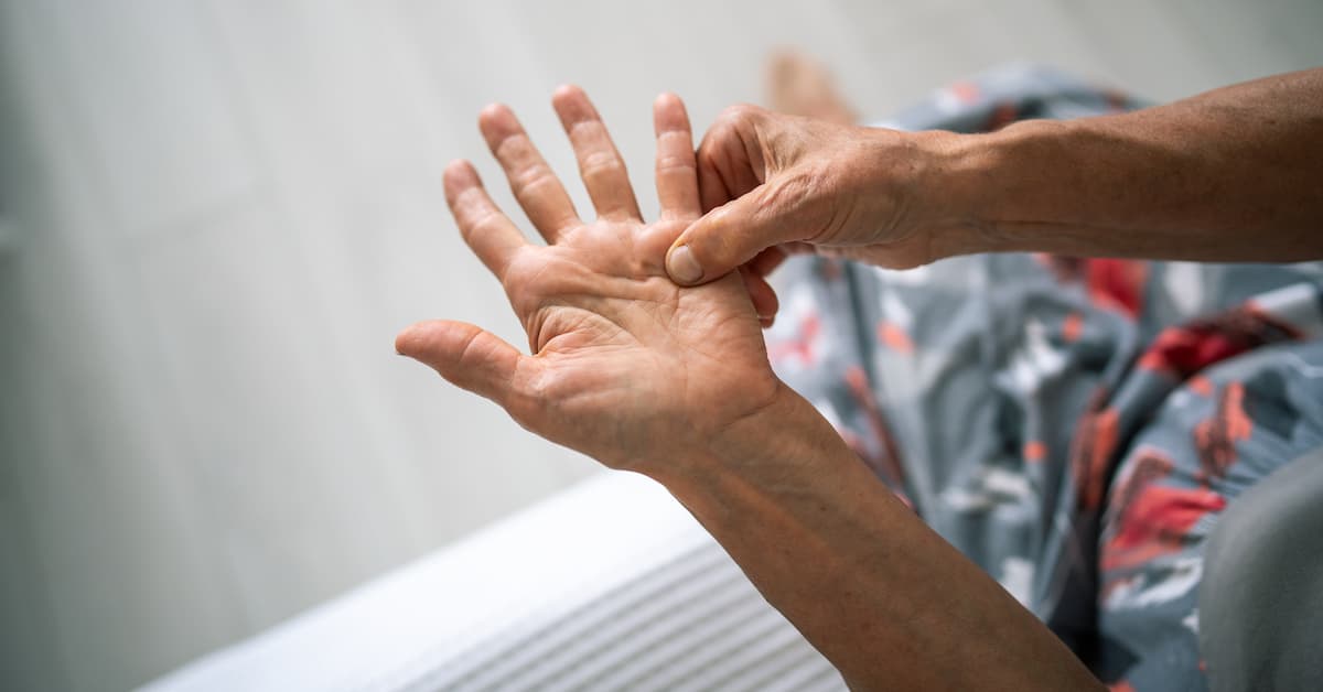 dupuytren's contracture diagnosis boise